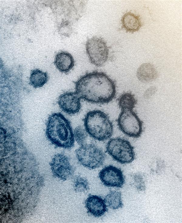 新冠病毒显微镜彩照首度公布！与 SARS 相似(图)